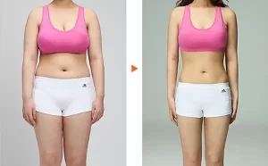 Giảm cân quá nhanh có hại không?